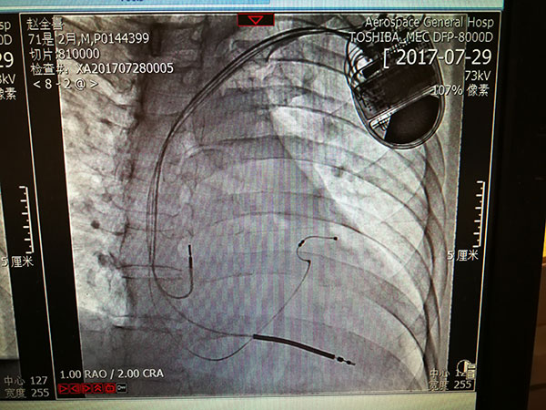 心內(nèi)科新技術(shù)照片1.jpg 心內(nèi)科新技術(shù)照片1.jpg