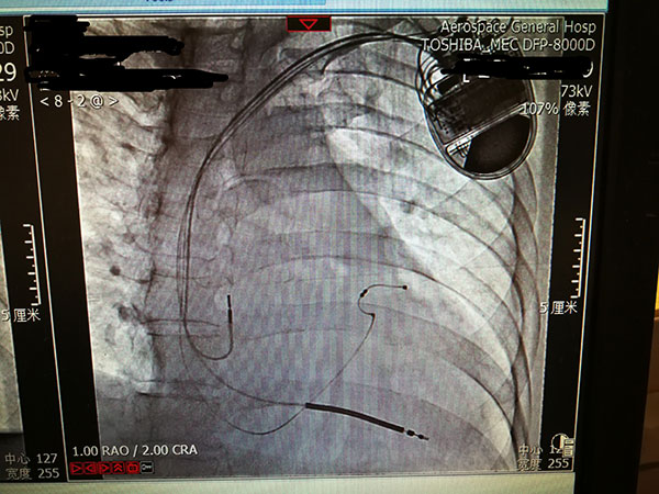 心內(nèi)科新技術(shù)照片1_副本.jpg 心內(nèi)科新技術(shù)照片1_副本.jpg